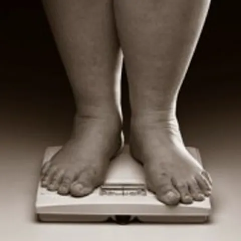 Obezitatea şi fumatul duc, în egală măsură, la deces, potrivit unui studiu 