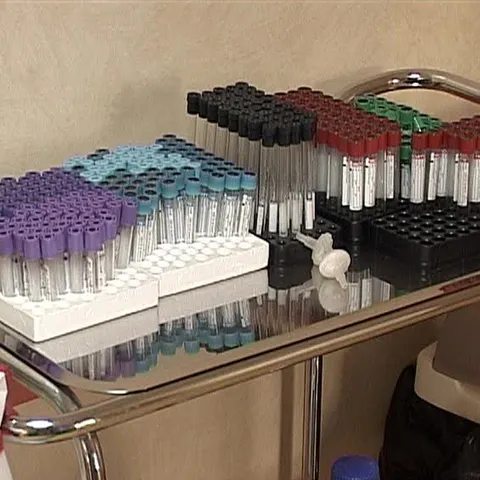 Costul unui set de analize la o clinică privată diferă de la un oraş la altul 