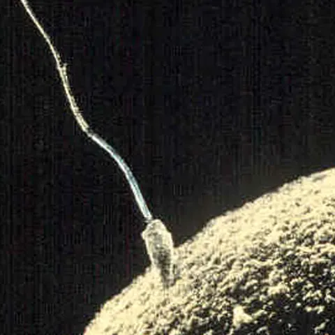 Cercetătorii britanici au reuşit să creeze spermatozoizi umani din celule suşă embrionare