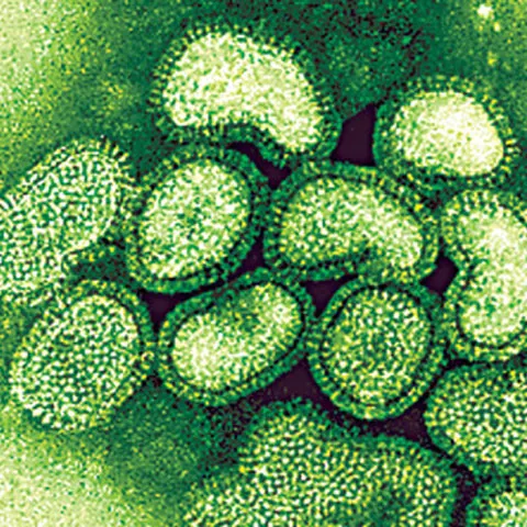 Count for Romania`s swine flu infections reaches 253, the Health Ministry says