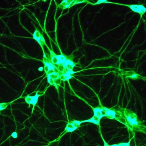 Celule stem "magnetice" pentru inimi 