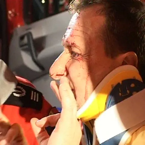 Maşina Ambasadei Rusiei a intrat într-un stâlp pe şoseaua Kiseleff 