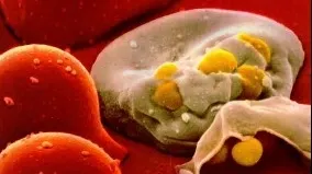 Numărul cazurilor de infectare cu HIV a scăzut în România cu 20%, în acest an