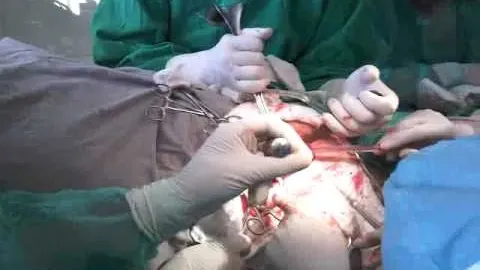 SUPER BACTERIA de spital care îi sperie pe specialiști. Se hrănește cu plasticul din bandaje și implanturi