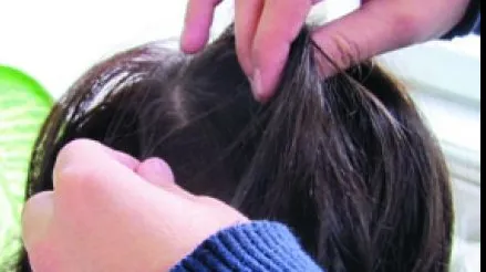 Focar de păduchi în şcoli: Cum prevenim transmiterea lor?