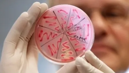 40 de elevi din Piteşti au E.coli, după ce au mâncat brânză la afterschool