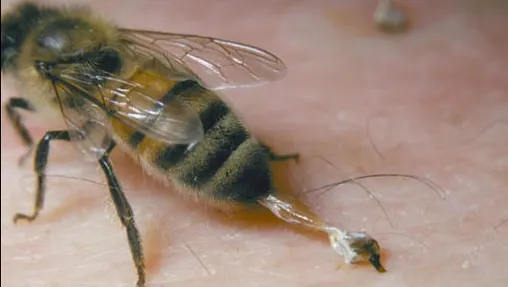 Leacuri contra înțepăturilor de insecte