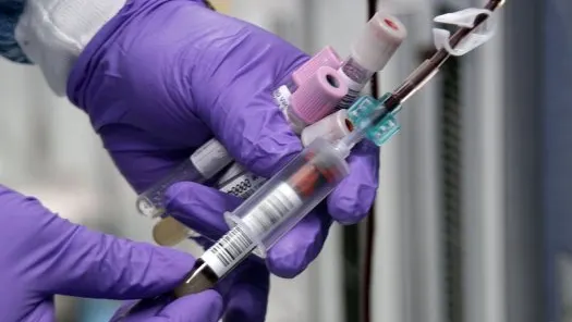 Un test de sânge va depista Alzheimerul