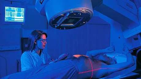 Radioterapia externă, tratament de precizie în lupta cu cancerul
