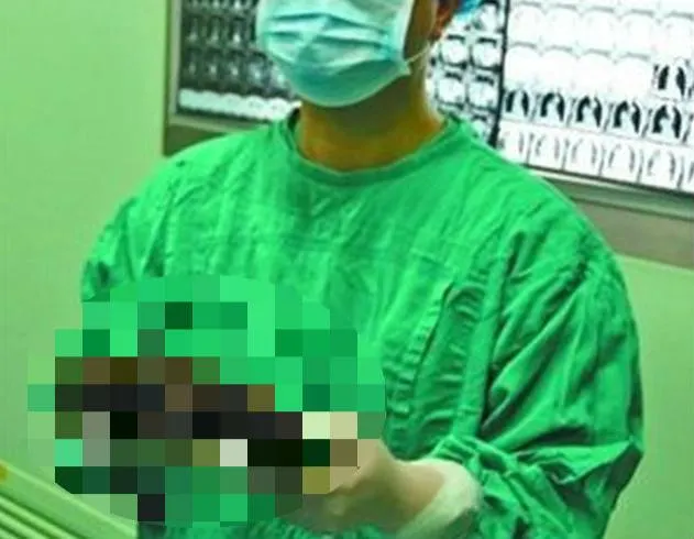 CAZ ŞOCANT. Ce au scos medicii din stomacul unei fetiţe de 12 ani. "Nu am mai văzut aşa ceva!"
