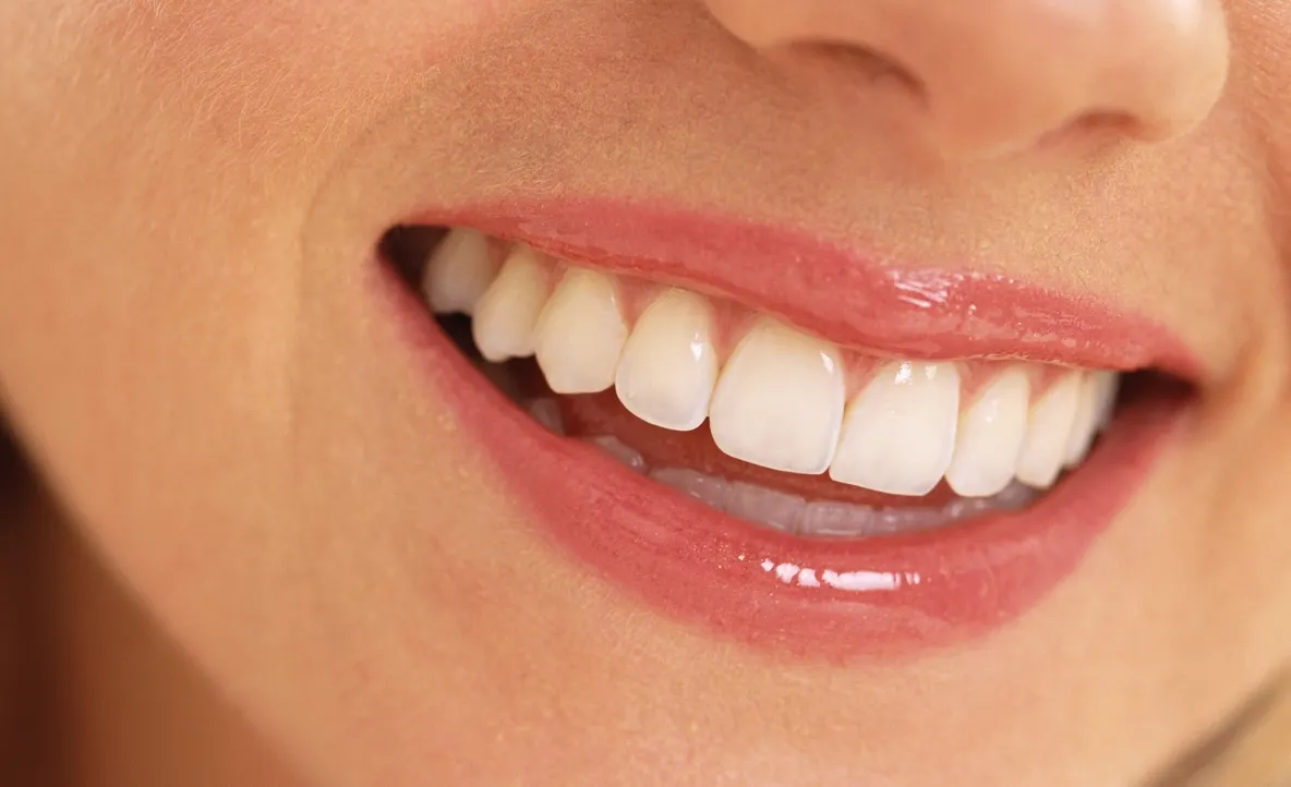 Adio, dinți galbeni! Cum obții un alb strălucitor fără să mergi la dentist