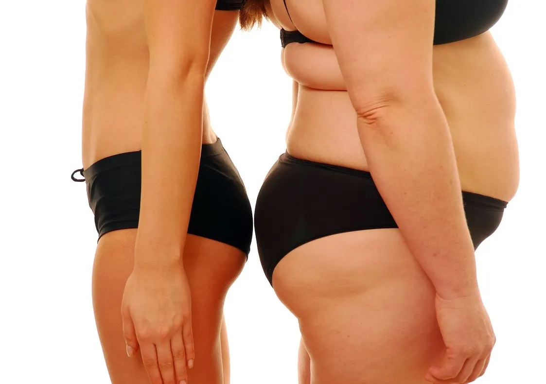 SĂNĂTATE. Plusurile şi minusurile abdominoplastiei