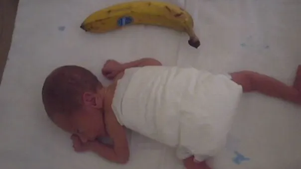"După ce s-a născut copilul, l-am pus în buzunar". Povestea "copilului-banană" ajuns campion  