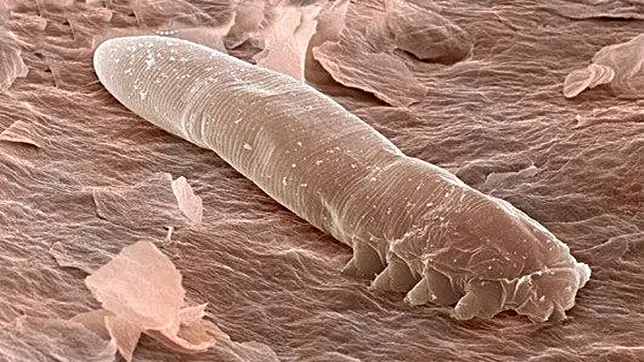 Nu le VEZI fără microscop, dar trăiesc pe pielea TUTUROR oamenilor - VIDEO înspăimântător