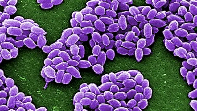ANTRAX, folosit în tratamentul pentru CANCER