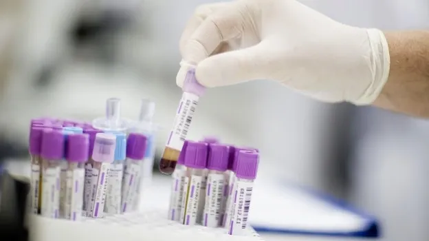 DESCOPERIRE INCREDIBILĂ în lupta cu CANCERUL