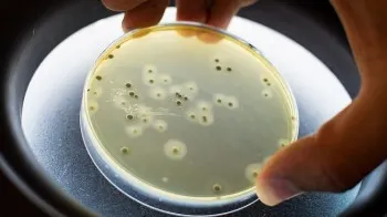 Alertă! Toate lacurile de pe râul Bistrița sunt infestate cu bacterie periculoasă