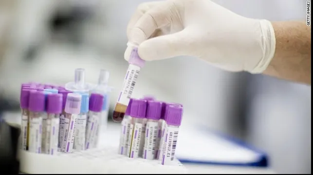 TESTUL care îţi spune dacă ai CANCER
