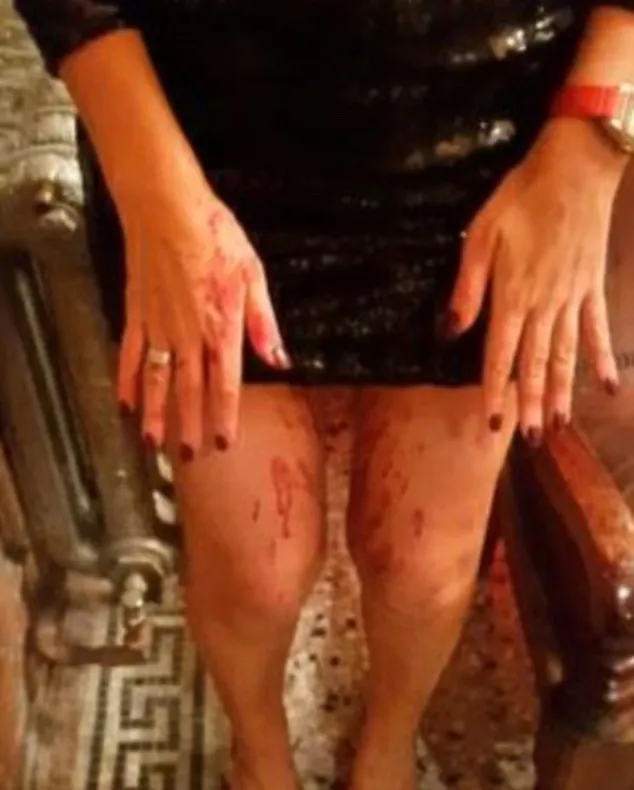 MODEL bătut cu bestialitate, într-un club. A fost atacată de NECUNOSCUŢI