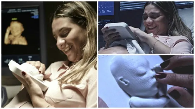 Ce face această mamă cu copilul ei nenăscut e fără precedent. Imaginile au emoționat lumea întreagă