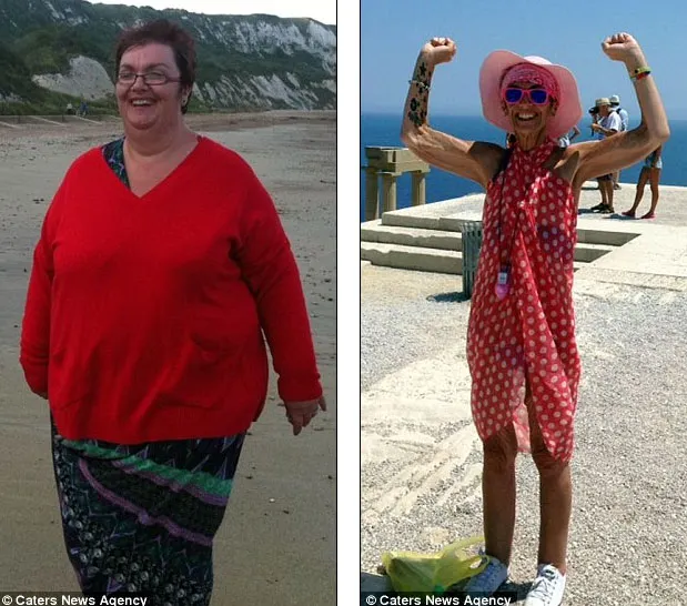 Era obeză şi a ajuns anorexică după ce a slăbit 127 de kilograme! Cum arată acum