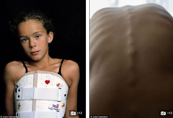 Cum a ajuns această adolescentă așa? Nimeni nu îi știa marele secret