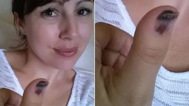 O fotografie devenită virală îți poate salva viața! Cum poate arăta cancerul de piele