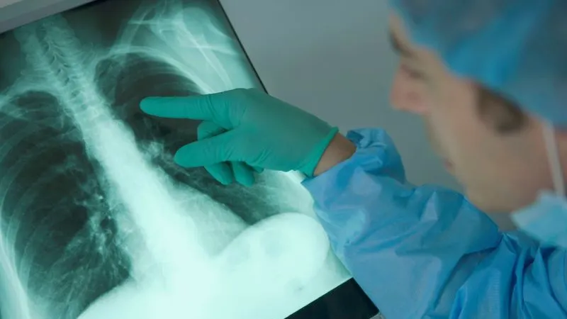 12 paşi ca să te fereşti de cancer, potrivit experţilor