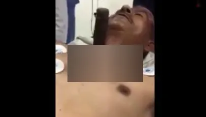 Imagini greu de privit. Are un cuțit înfipt lângă inimă, dar vorbește fără probleme
