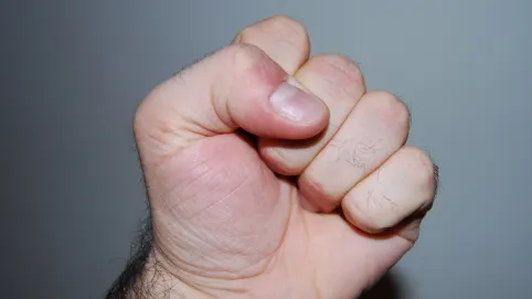 Bătaie cu repetiţie, la Cluj. De ce a fost bătut un bărbat de acelaşi agresor: "Nu mai era aşa beat"