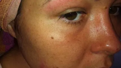 Cum s-a trezit o tânără după ce şi-a tatuat sprâncenele la salon: "Acum am patru"