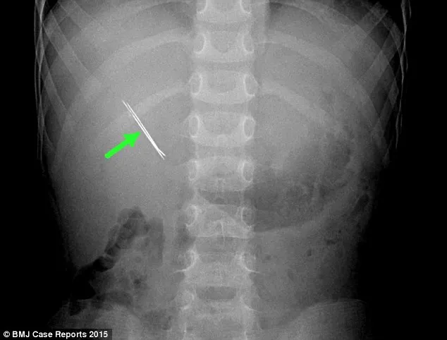 I-au făcut o radiografie copilului lor și au descoperit ceva ȘOCANT