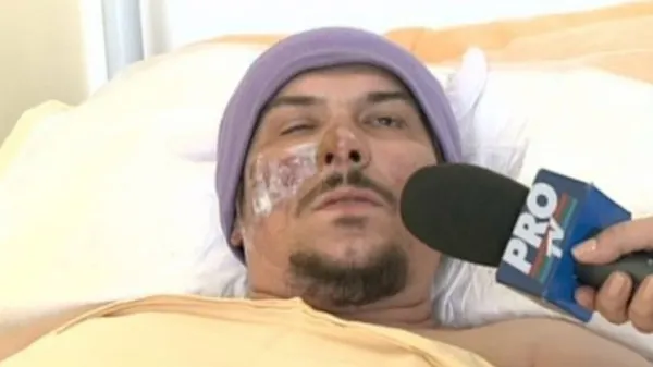 Mărturii din clubul groazei. Basistul trupei Monarchy, rănit: "Incendiul s-a propagat ciudat"