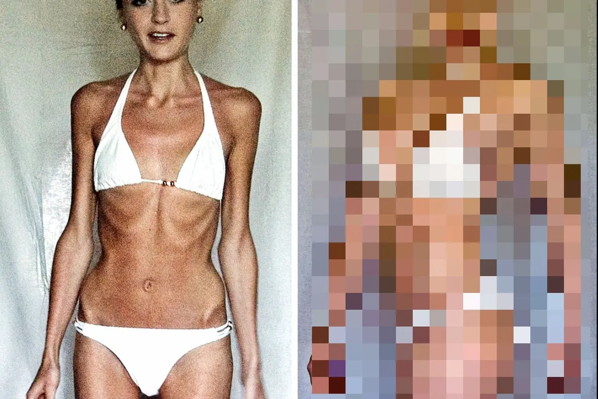 Era să moară din cauza anorexiei. Transformarea incredibilă a tinerei după ce s-a apucat de fitness