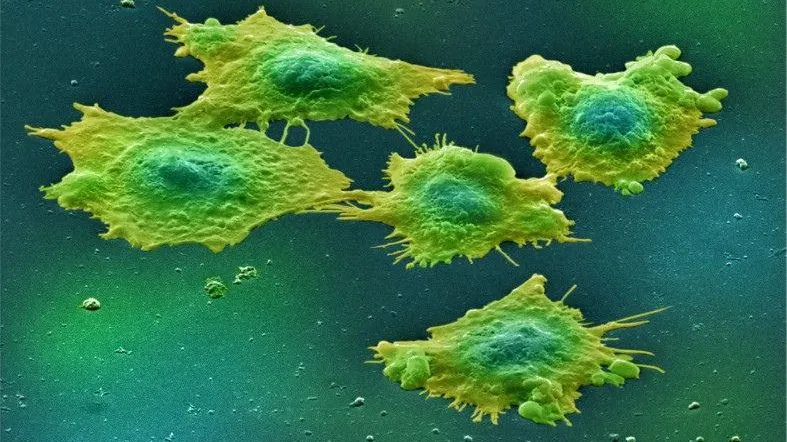 S-a descoperit: alimentul acesta provoacă patru tipuri de cancer. Renunţi la el?