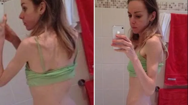 Transformare incredibilă. Cântărea doar 37 de kilograme, dar acum toată lumea o admiră