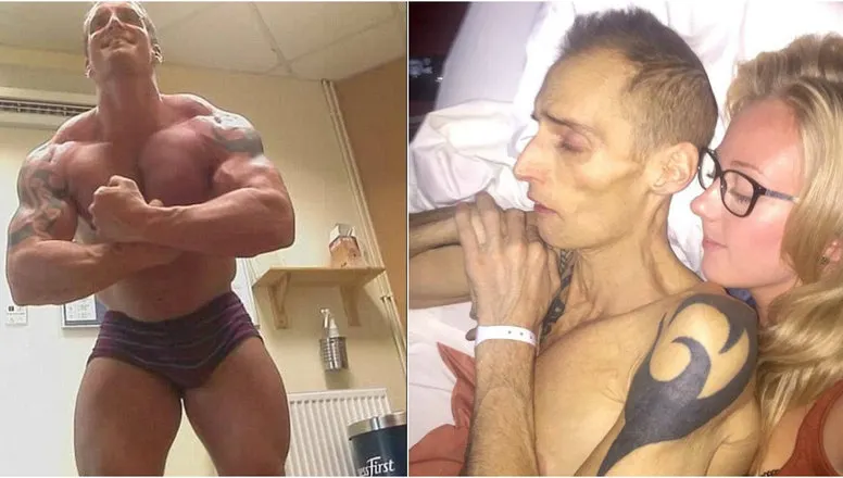 Era sportiv și sănătos tun, dar a slăbit brusc și a murit. Medicii au aflat de ce și au rămas șocați