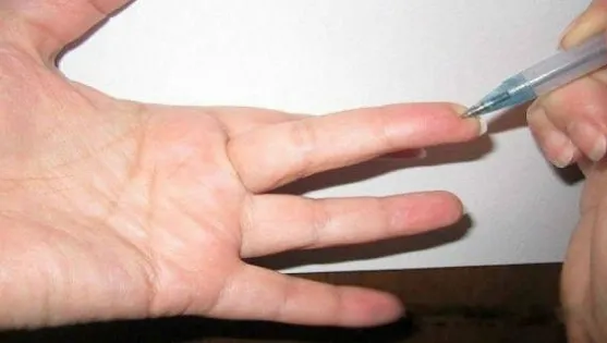 Ce se întâmplă dacă apeşi acest punct de pe deget? Metodă de tratament folosită şi de puşcaşi marini