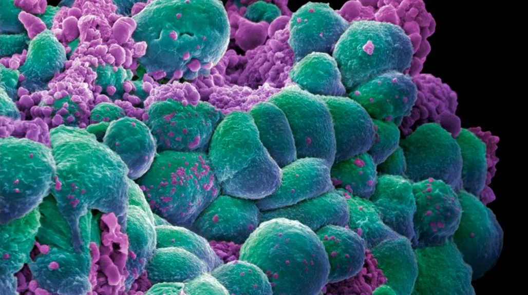 Leguma care distruge celulele canceroase. Cum se consumă