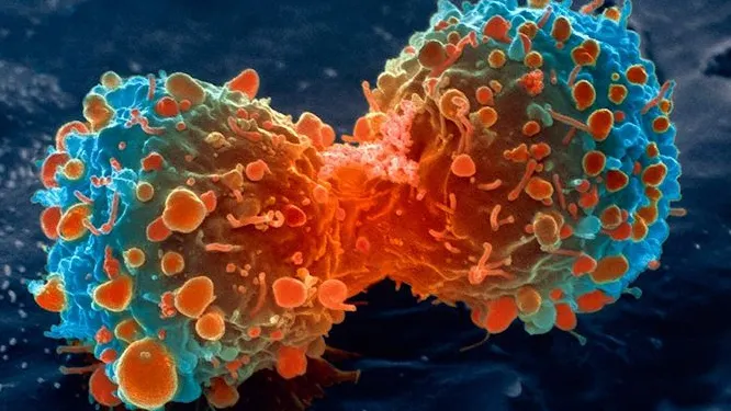 Un tratament experimental împotriva cancerului are rezultate excepţionale