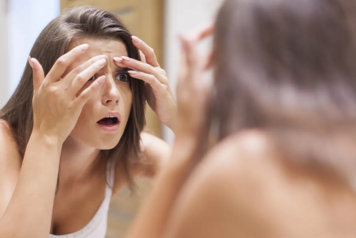 4 mituri false despre acnee. Nu apare doar la ADOLESCENȚI și nu e cauzată de igiena precară
