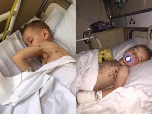 Băiatul a făcut dintr-odată febră mare. Mama a realizat atunci ce greșeală fatală au făcut medicii
