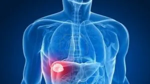 Cum ne detoxifiem ficatul după Paşte? Acesta este cel mai simplu remediu natural
