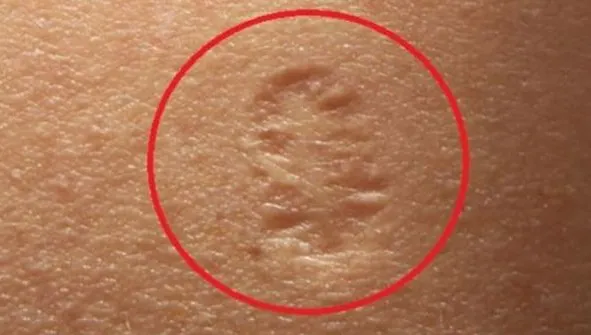 Toți avem acest semn pe mână, însă știi ce înseamnă cu adevărat?