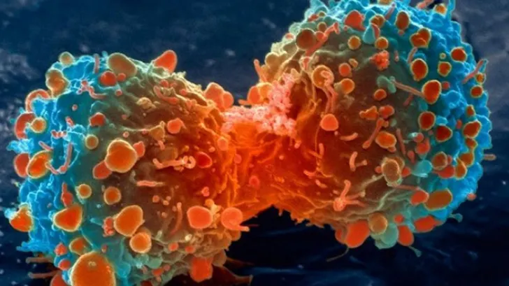 Cum arată fructele care ucid cancerul într-un minut. Medicii, ŞOCAŢI când au văzut efectele