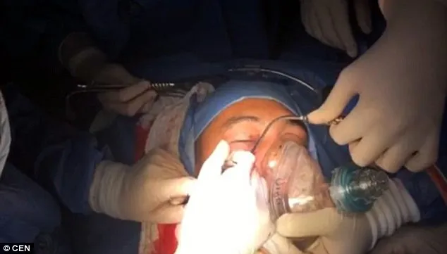 A venit la spital cu o grenadă amorsată în cap. Medicii, în stare de șoc. Ce au văzut la radiografie