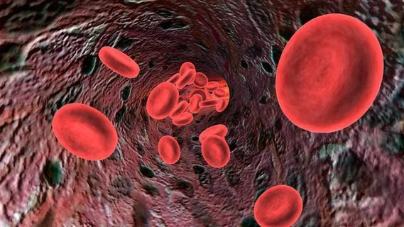 AŞA îţi cureţi sângele de toate toxinele