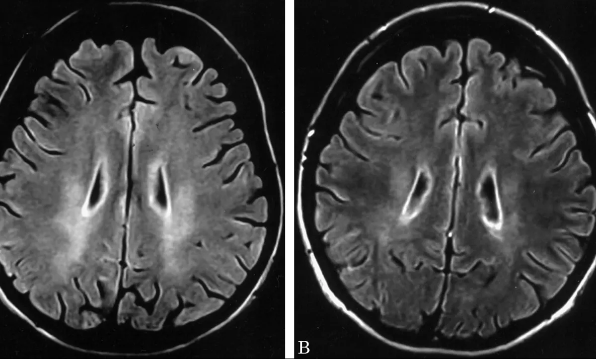 ŞOC în lumea sportivă: un celebru antrenor, diagnosticat cu o maladie neurologică. Ar putea paraliza