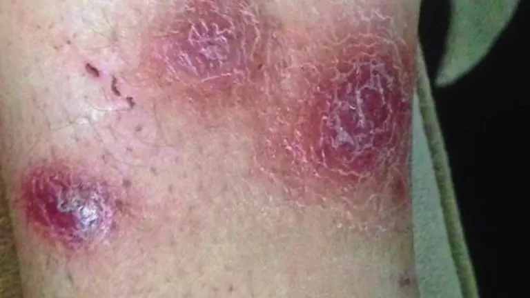 S-a dus să-şi facă pedichiura, iar după câteva zile a ajuns la spital!