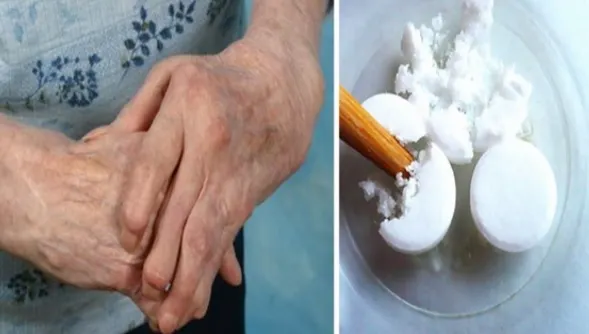 Acest preparat din 3 ingrediente simple întăreşte oasele cu 20 de ani